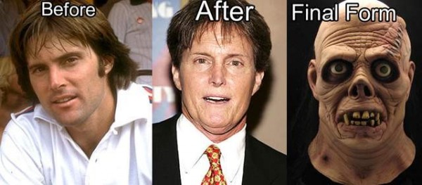 Devenir un Zombiebrucejenner